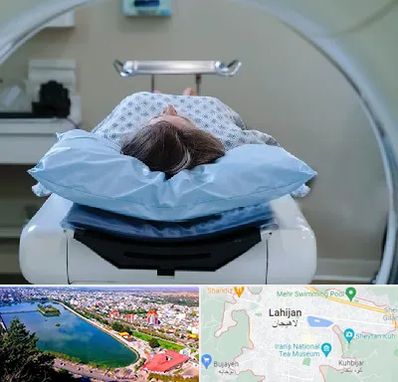 رادیولوژی فک و صورت در لاهیجان