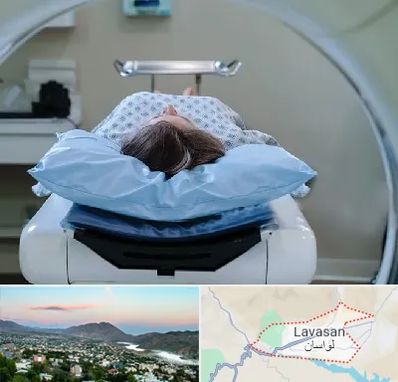 رادیولوژی فک و صورت در لواسان