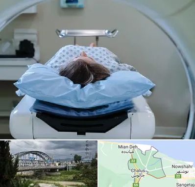 رادیولوژی فک و صورت در چالوس