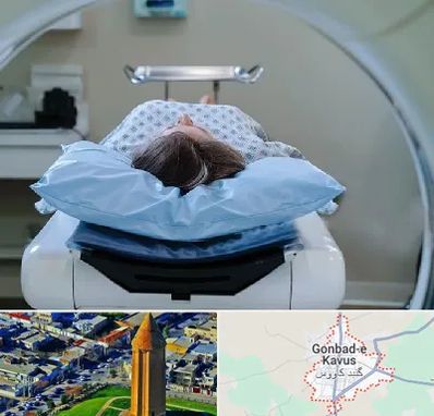 رادیولوژی فک و صورت در گنبد کاووس