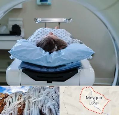 رادیولوژی فک و صورت در میگون