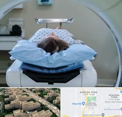 رادیولوژی فک و صورت در اکباتان 