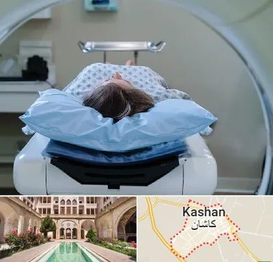 رادیولوژی فک و صورت در کاشان