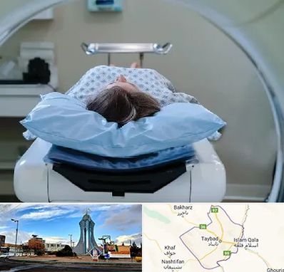 رادیولوژی فک و صورت در تایباد