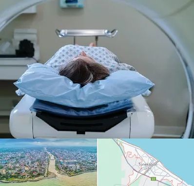 رادیولوژی فک و صورت در تنکابن