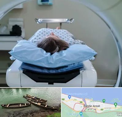 رادیولوژی فک و صورت در بندر انزلی