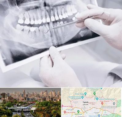 رادیولوژی دهان و دندان در منطقه 1 تهران