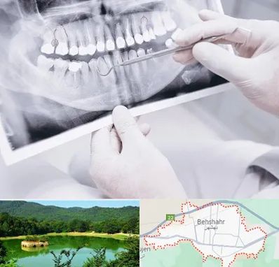 رادیولوژی دهان و دندان در بهشهر