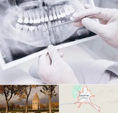 رادیولوژی دهان و دندان در تویسرکان