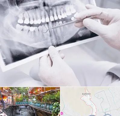 رادیولوژی دهان و دندان در درکه