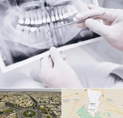 رادیولوژی دهان و دندان در قزوین