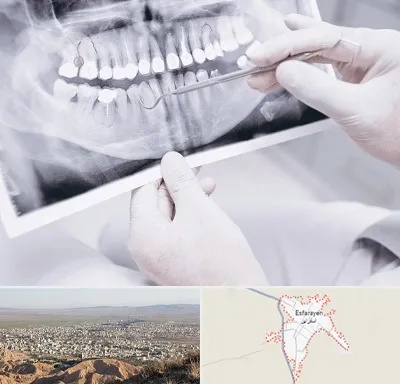 رادیولوژی دهان و دندان در اسفراین