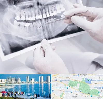 رادیولوژی دهان و دندان در چیتگر 