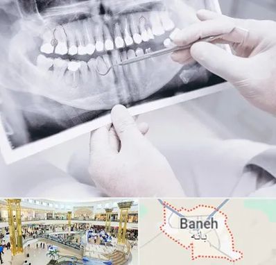 رادیولوژی دهان و دندان در بانه