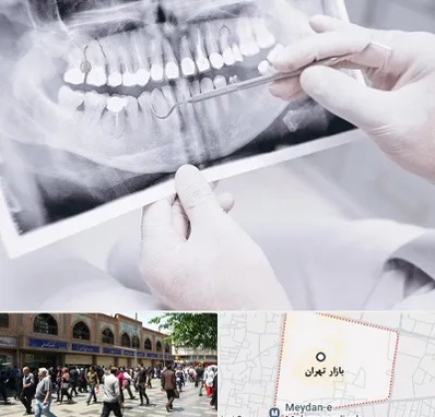 رادیولوژی دهان و دندان در بازار تهران