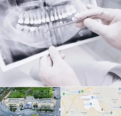 رادیولوژی دهان و دندان در نسیم شهر