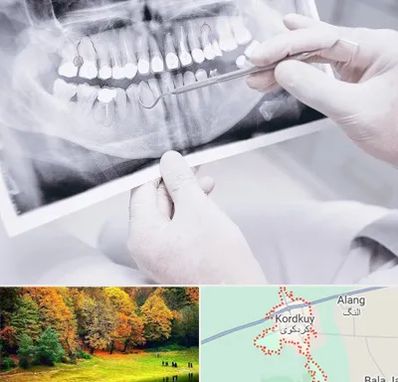 رادیولوژی دهان و دندان در کردکوی