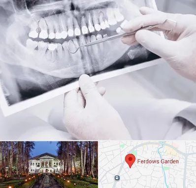 رادیولوژی دهان و دندان در باغ فردوس