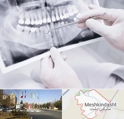 رادیولوژی دهان و دندان در مشکین دشت