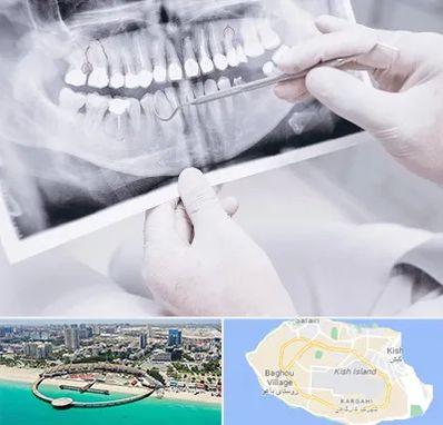 رادیولوژی دهان و دندان در کیش