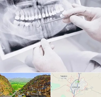 رادیولوژی دهان و دندان در کامیاران
