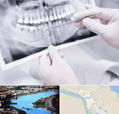 رادیولوژی دهان و دندان در خرمشهر