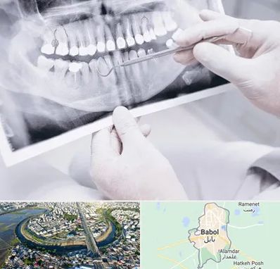 رادیولوژی دهان و دندان در بابل