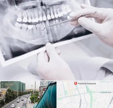 رادیولوژی دهان و دندان در بلوار فرحزادی