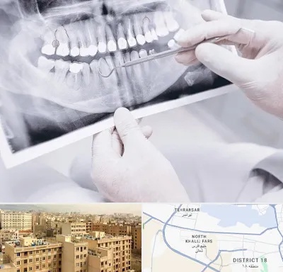 رادیولوژی دهان و دندان در جنوب غرب تهران