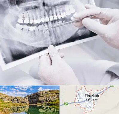 رادیولوژی دهان و دندان در فیروزکوه
