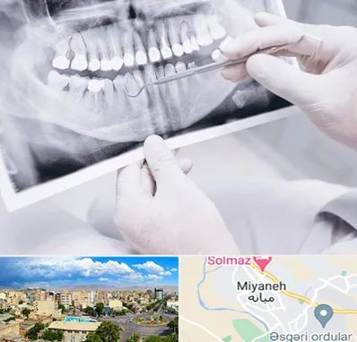 رادیولوژی دهان و دندان در میانه