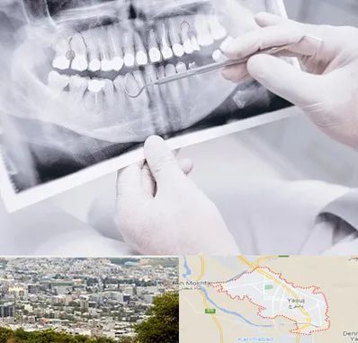 رادیولوژی دهان و دندان در یاسوج