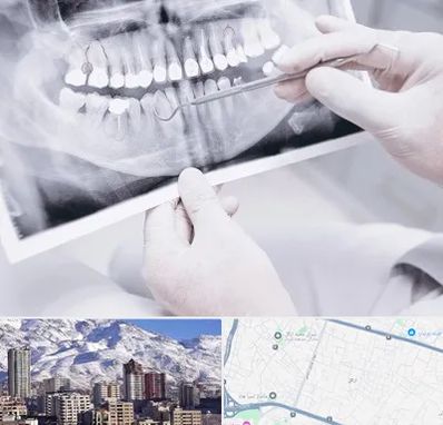 رادیولوژی دهان و دندان در ازگل