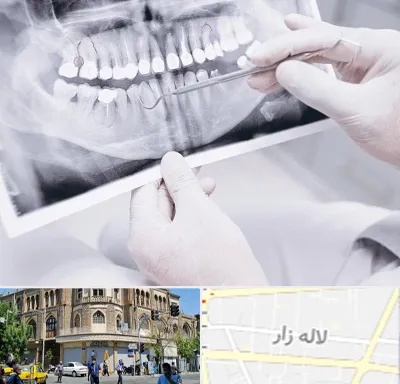 رادیولوژی دهان و دندان در لاله زار