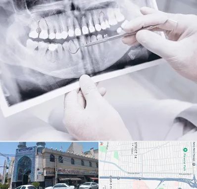 رادیولوژی دهان و دندان در بلوار ابوذر