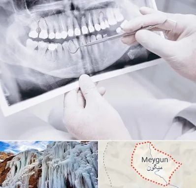 رادیولوژی دهان و دندان در میگون