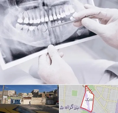 رادیولوژی دهان و دندان در اتابک