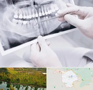 رادیولوژی دهان و دندان در بهبهان