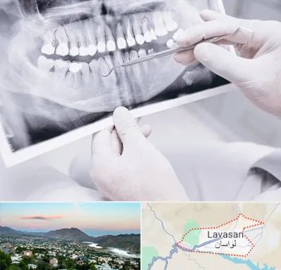 رادیولوژی دهان و دندان در لواسان