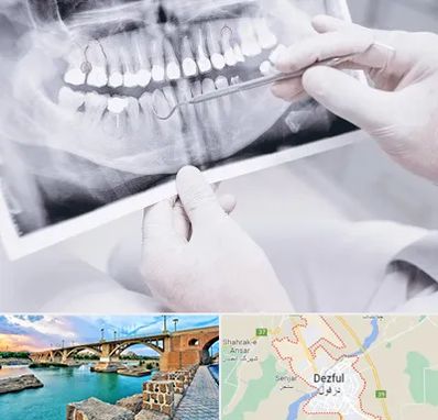 رادیولوژی دهان و دندان در دزفول