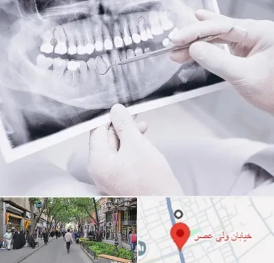 رادیولوژی دهان و دندان در ولیعصر شهریار