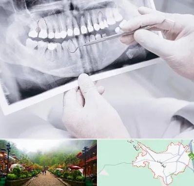 رادیولوژی دهان و دندان در فومن