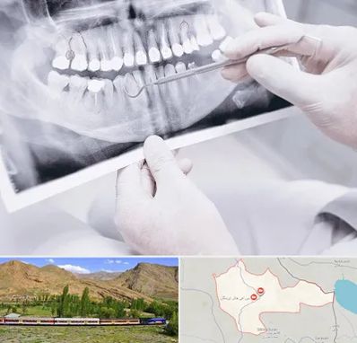 رادیولوژی دهان و دندان در خاش