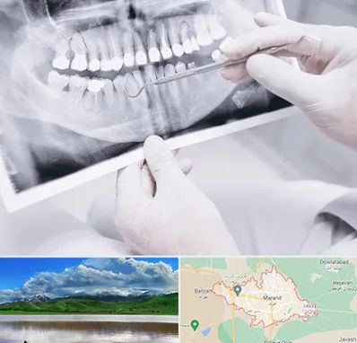 رادیولوژی دهان و دندان در مرند
