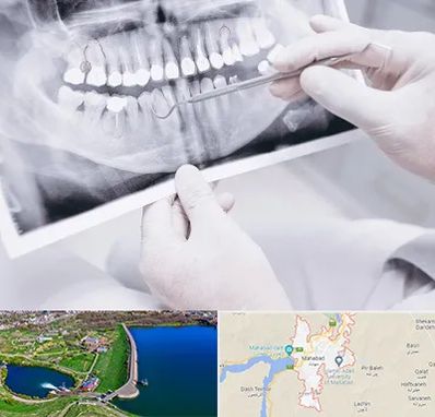 رادیولوژی دهان و دندان در مهاباد
