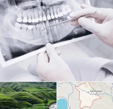 رادیولوژی دهان و دندان در گچساران