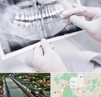 رادیولوژی دهان و دندان در مراغه