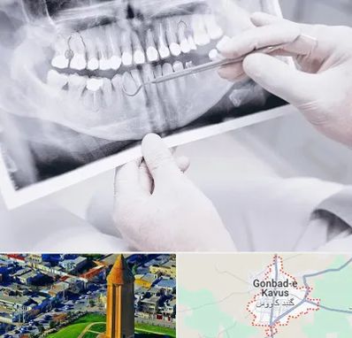 رادیولوژی دهان و دندان در گنبد کاووس