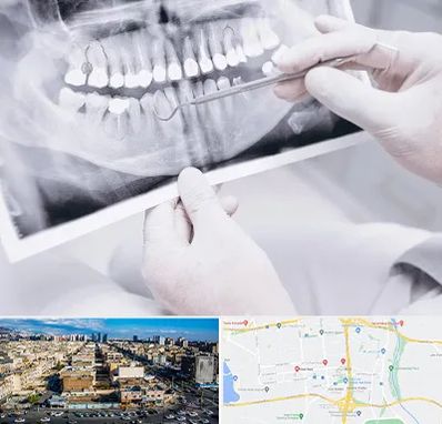 رادیولوژی دهان و دندان در شهرک راه آهن
