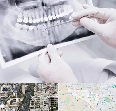 رادیولوژی دهان و دندان در منطقه 18 تهران